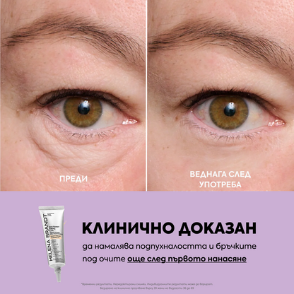Лифтинг крем за околоочен контур